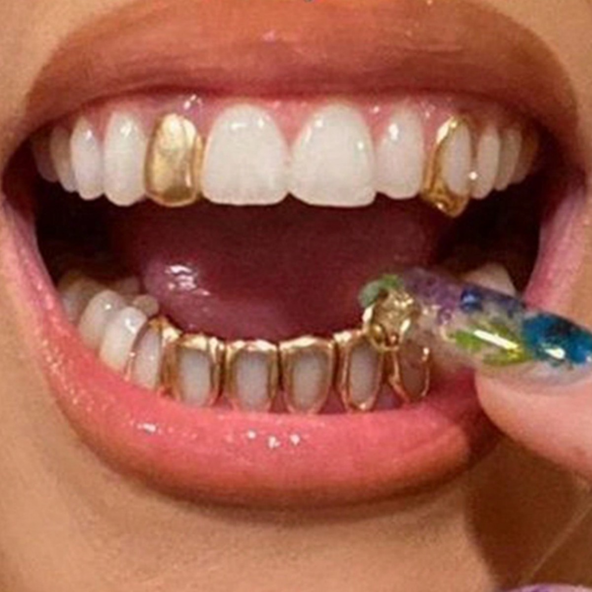 Body Jewelry Stores - ฟันปลอมฮิปฮอปแบบแบน 6 รู ลดราคาพิเศษ ชุด 3